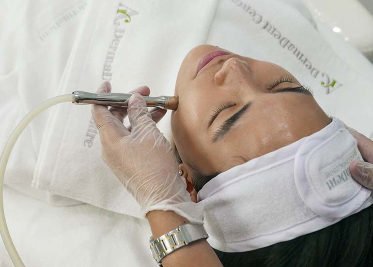 Affordable Diamond Peel Facials That’ll Fit Your Budget